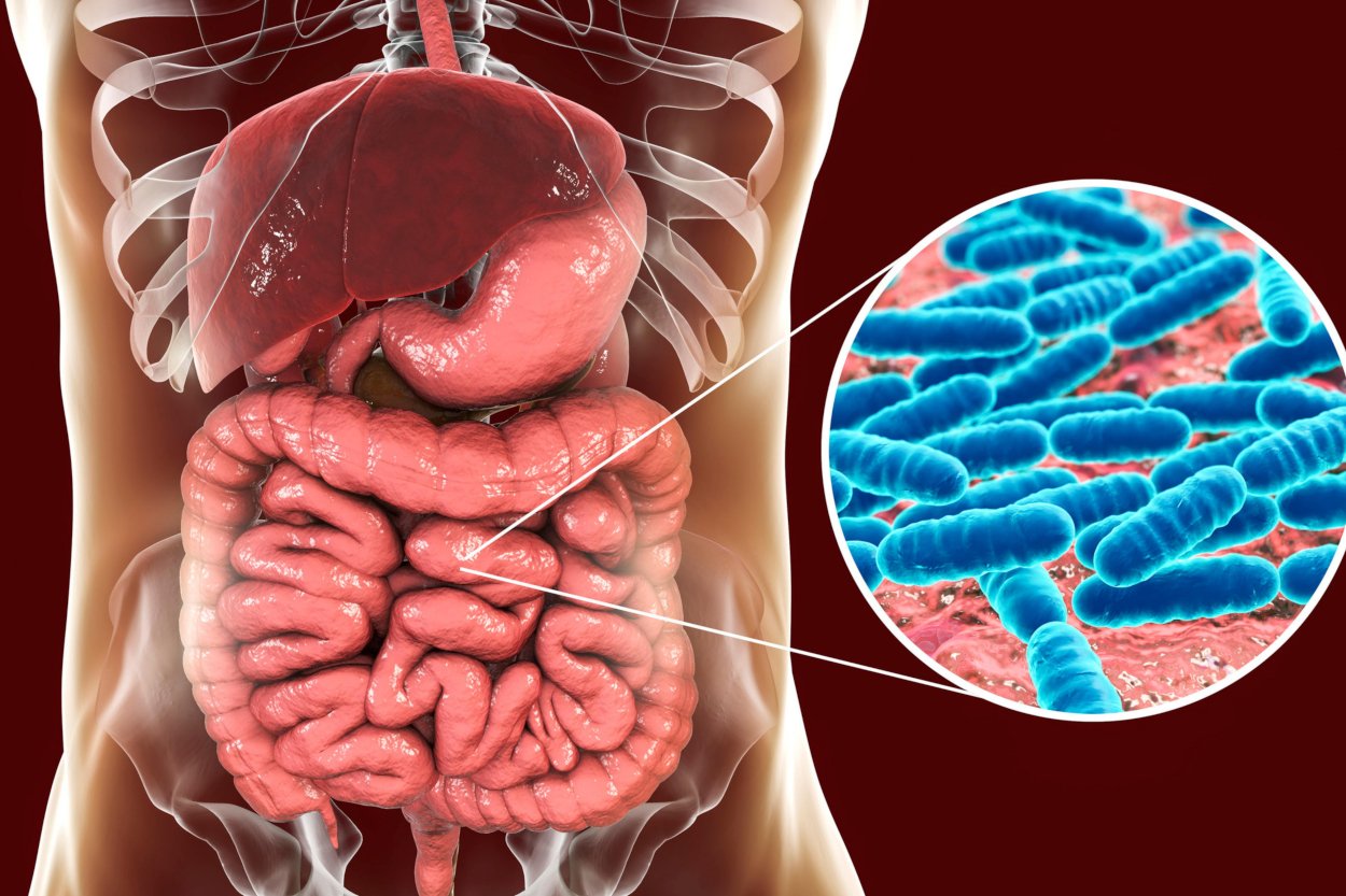 Intestinal inflammation